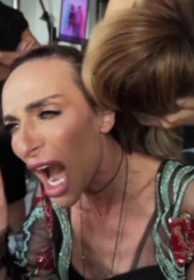 «Свои волосы от недоедания повыпадали»: Екатерина Варнава показала себя без парика