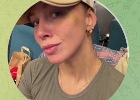 «Никто меня не бил»: Полина Диброва вышла на связь из аэропорта с синяком под глазом