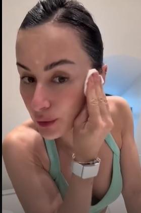 «Я делаю ботокс у профессора»: Тина Канделаки показала лицо без макияжа