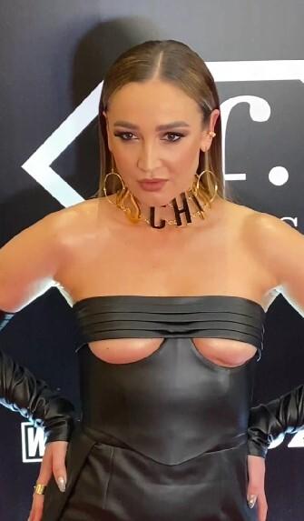 Пластический хирург объяснил, откуда взялись странные шрамы на груди Бузовой