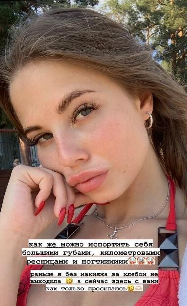 «Как же можно испортить себя большими губами»: невестка Валерии пожаловалась на внешность