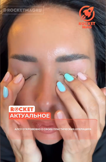 «Надоели!»: Алсу ответила на слухи о многочисленных пластических операциях