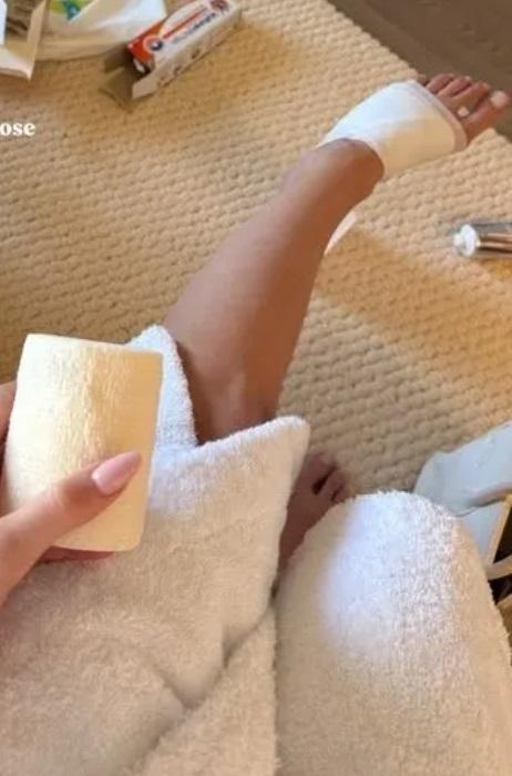 «Не могу ничего делать»: возлюбленная Павла Дурова получила травму