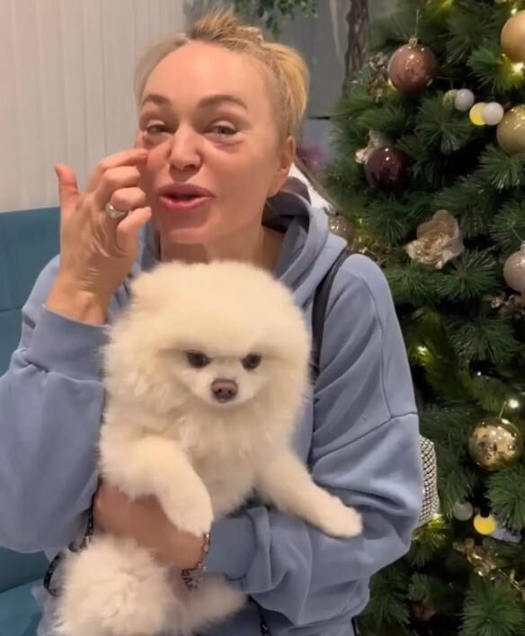 Вкололи жир в лицо: хирург прокомментировала очередную пластику Довлатовой