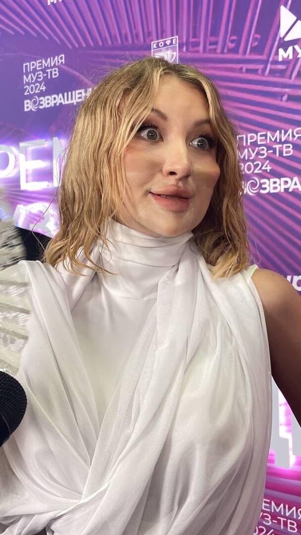«Я ко всему готова»: фаворитка Киркорова показала лицо после пластики на премии МУЗ-ТВ