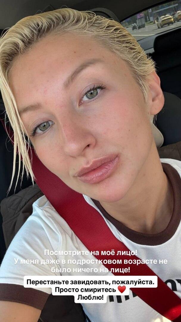 «Перестаньте завидовать!»: Марго пожаловалась на проблемы со здоровьем