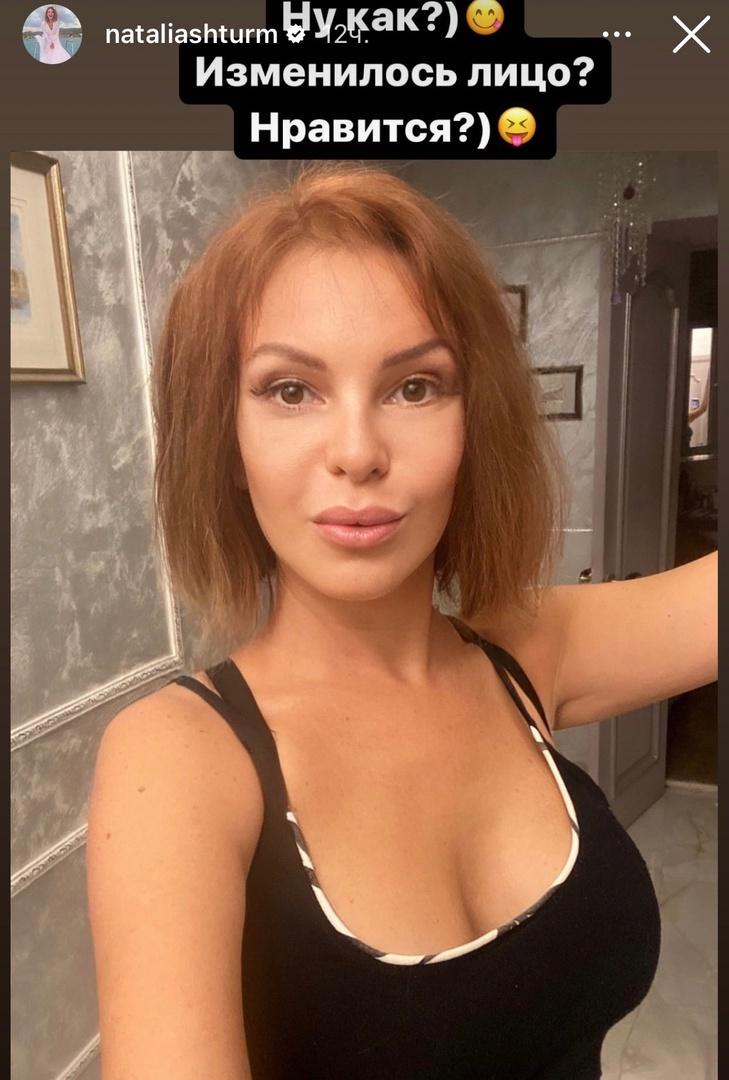 «Изменилось»: мечтающая о молодости Наталья Штурм показала лицо после пластики