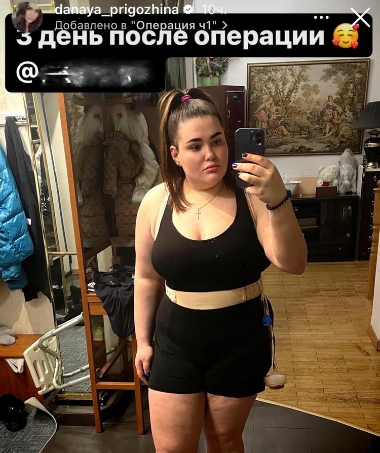 «Это серьезный шаг»: дочь Пригожина показала тело после пластической операции