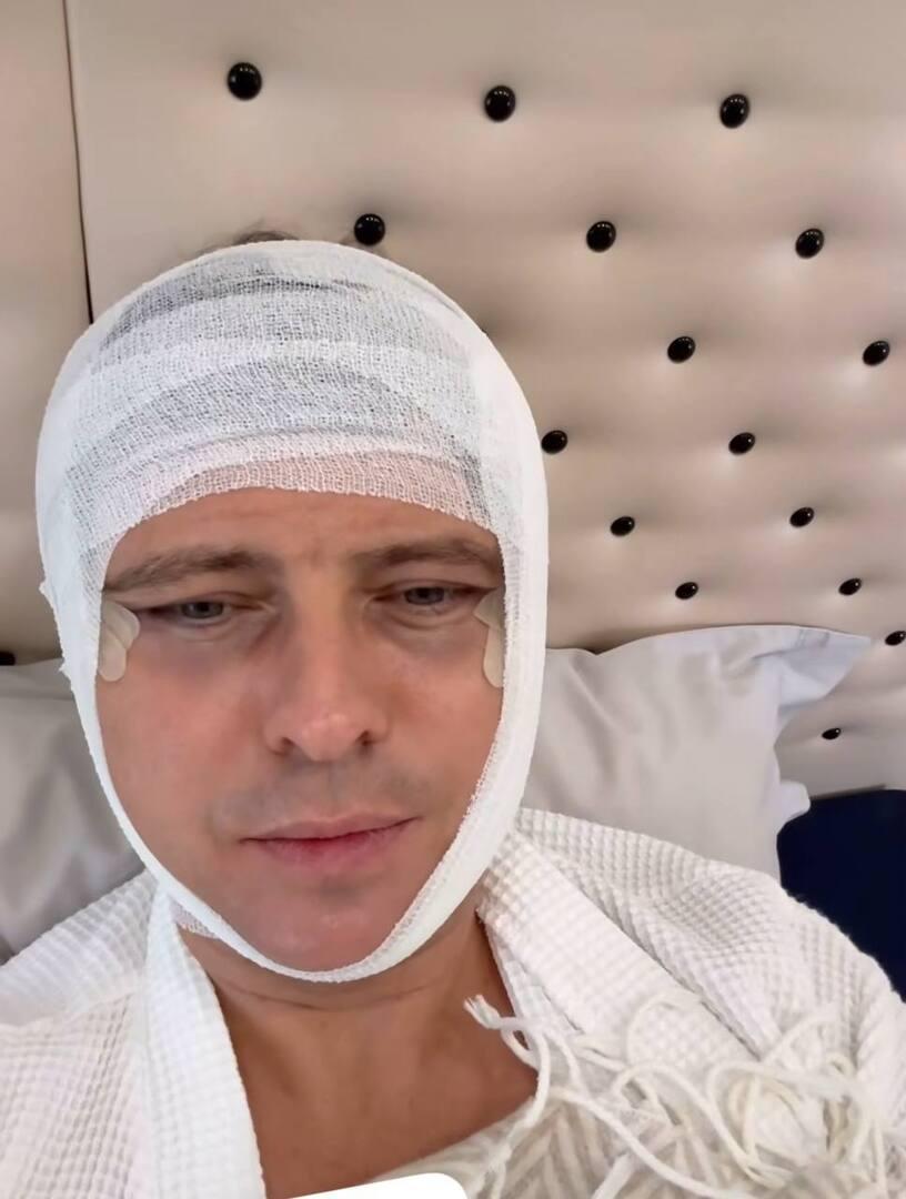 Прохор Шаляпин показал лицо в бинтах после пластической операции