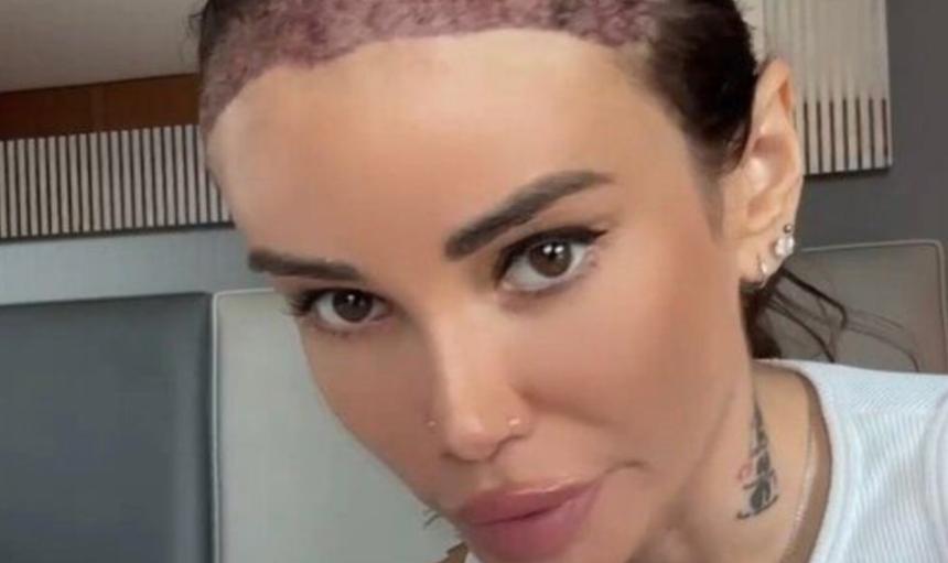 Айза сделала себе жуткую пластическую операцию