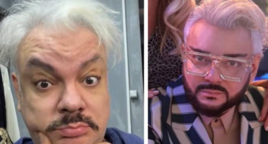 Лицо Филипа Киркорова начало покрываться шрамами