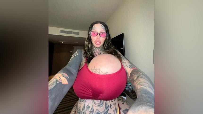 «Как пакет с водой»: почему грудь канадской фрик-модели лопнула в самолете