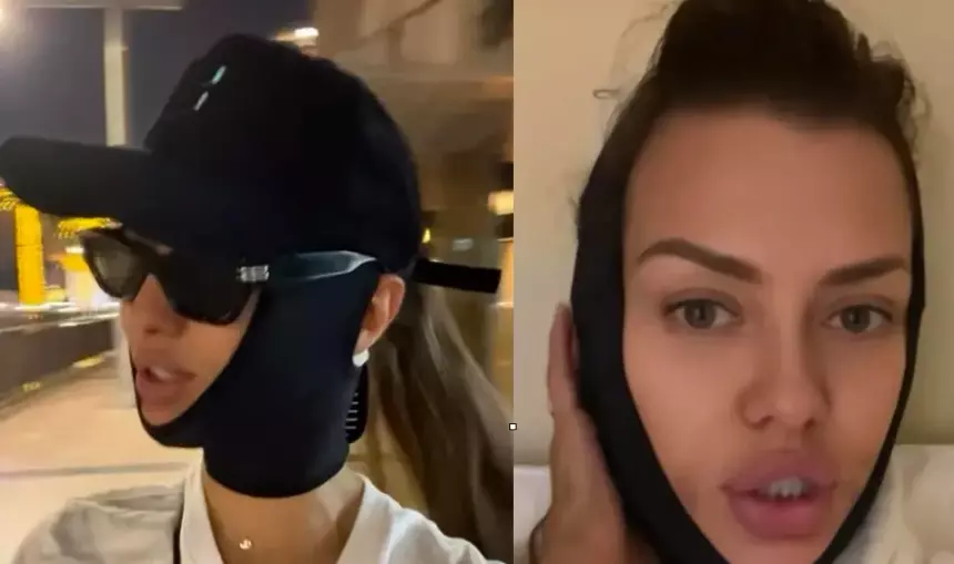 Сняли в черной повязке: Виктория Боня перекроила лицо ради нового мужчины