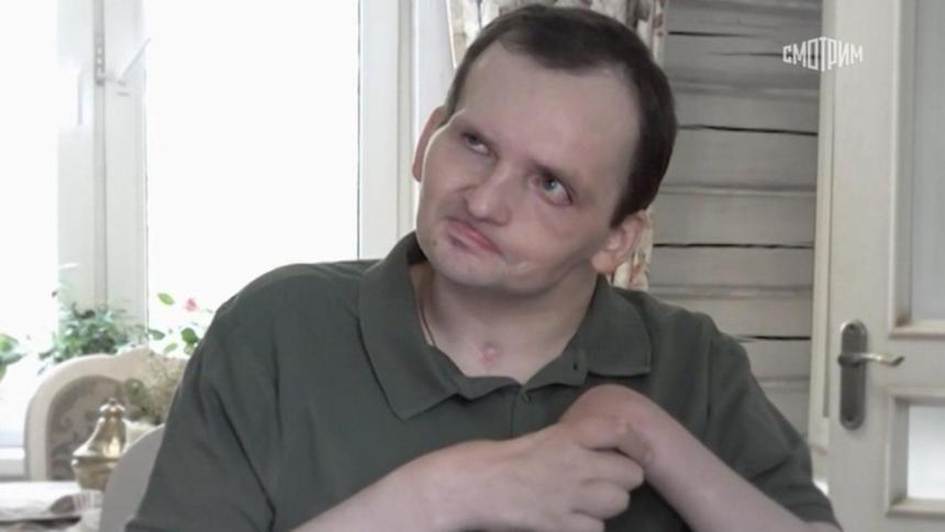 Нет зубов и не открываются полностью глаза: как сейчас выглядит переживший инсульт актер Янин