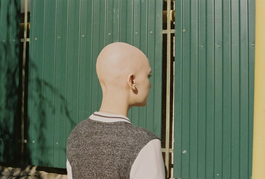 «Это была настоящая каторга»: актриса с алопецией рассказала о детстве в больницах