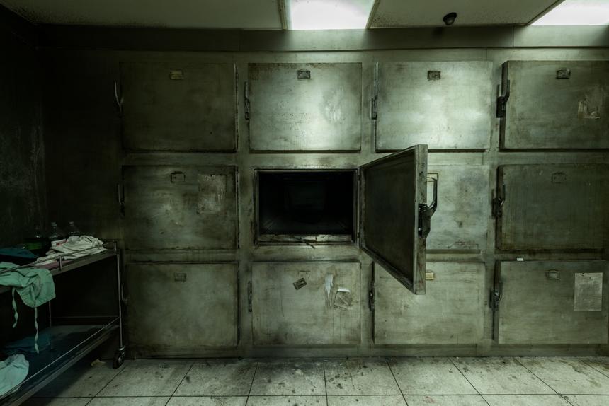 Певица Анастасия обнаружила огромный синяк на лице умершей в психбольнице матери