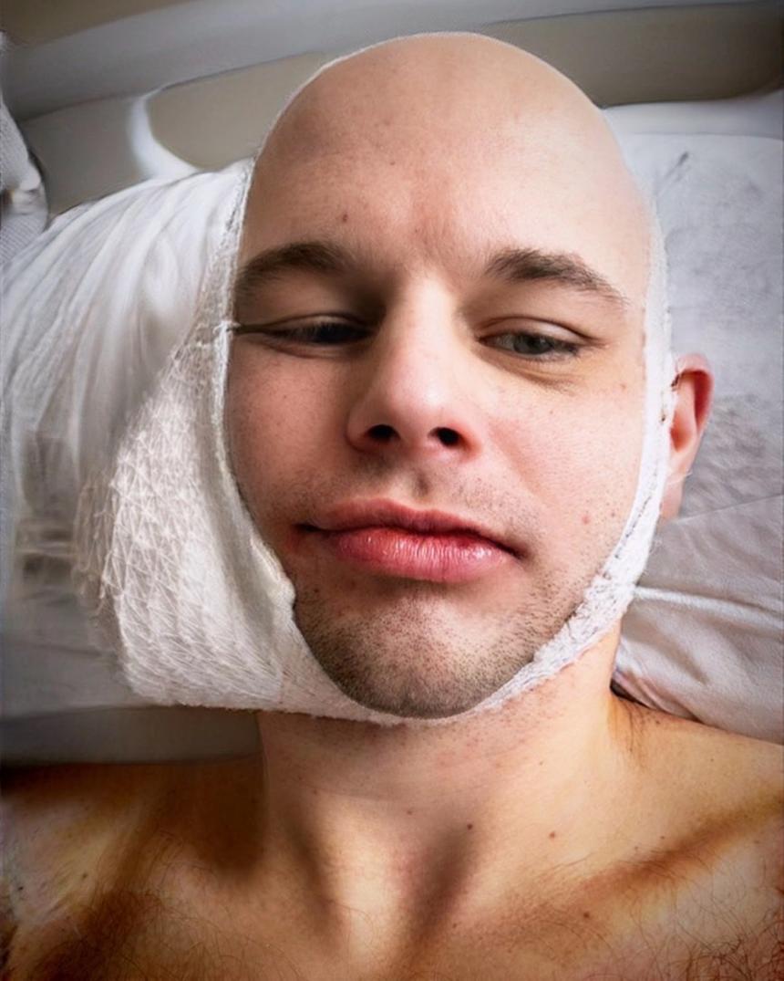 Tomilove после нападения