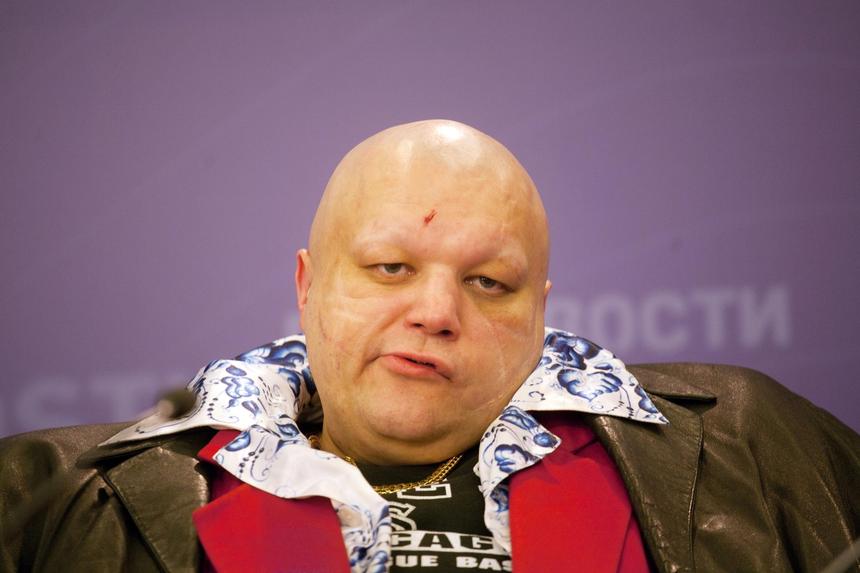 «Лолиту — в санитарки»: Барецкий придумал наказание для оскандалившихся на вечеринке Ивлеевой звезд