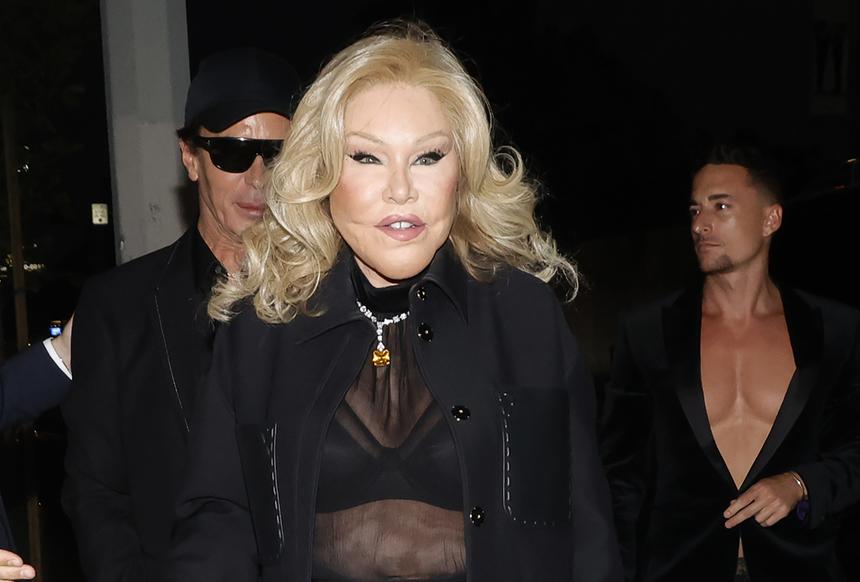 84-летняя «женщина-кошка» Джослин Вильденштейн показала себя до пластики лица