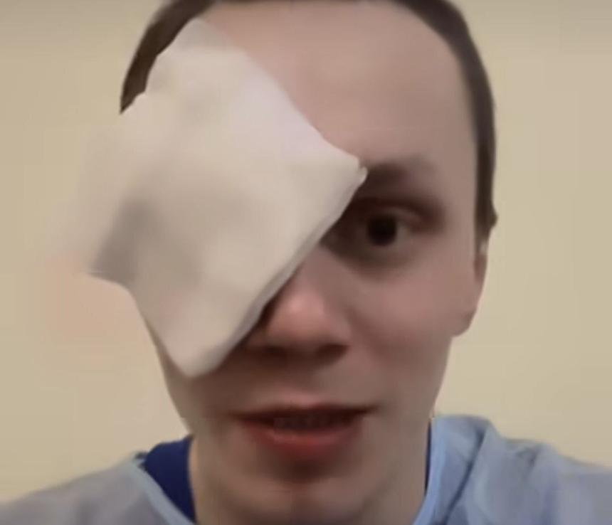 Это произошло не на ринге: блогер и боец поп-ММА Корней Тарасов лишился левого глаза