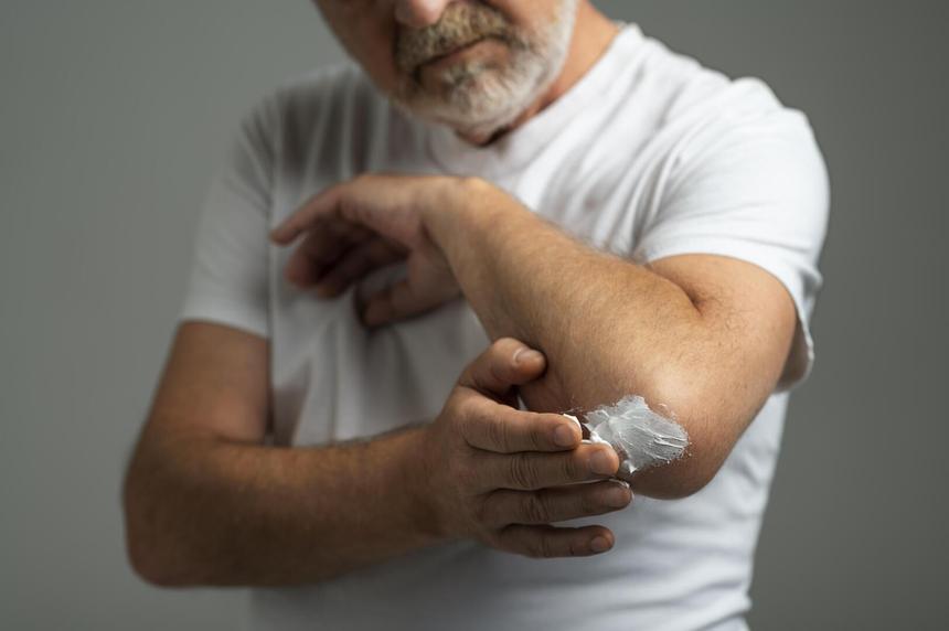 Появились огромные волдыри на шее и руках: москвич спрятался в кустах от дождя и вскоре попал в больницу