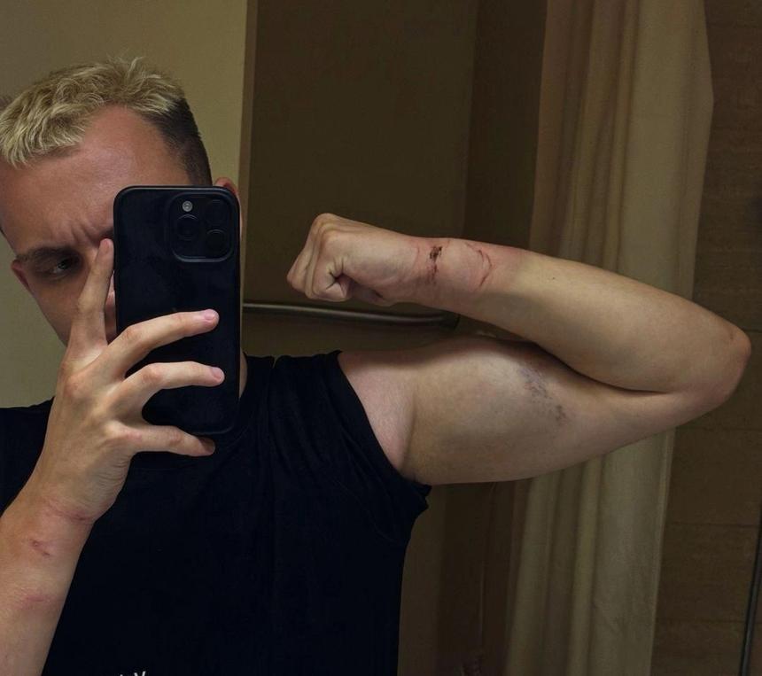 Собирался убить и покончить с собой: что известно о напавшем на Гликогена