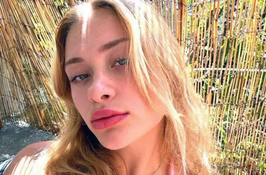 «Ее по частям собрали»: сколько операций перенесла покалеченная в Дубае модель Мария Ковальчук