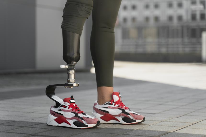 Даже не извинился: семья 15-летней девушки, которая потеряла ногу в ДТП, опасается безнаказанности виновника